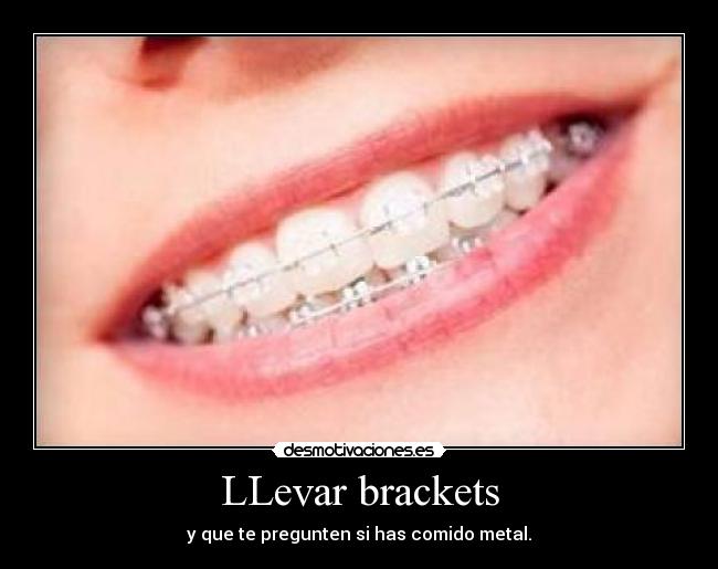 carteles brackets desmotivaciones