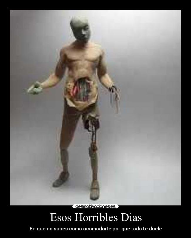 Esos Horribles Dias - En que no sabes como acomodarte por que todo te duele