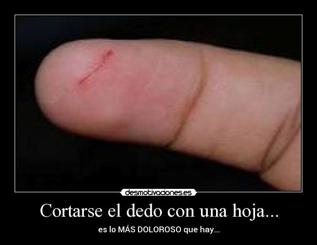 Cortarse el dedo con una hoja... - 