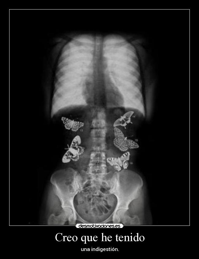 Creo que he tenido - una indigestión.