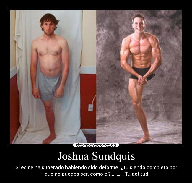 Joshua Sundquis - Si es se ha superado habiendo sido deforme. ¿Tu siendo completo por
que no puedes ser, como el? .......... Tu actitud