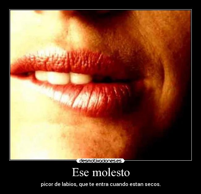 Ese molesto -