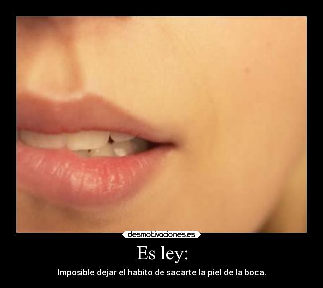 Es ley: -