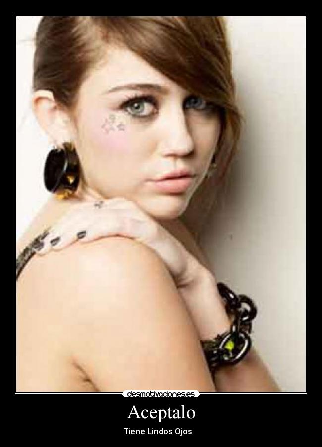 Aceptalo - Tiene Lindos Ojos ♥♥♥