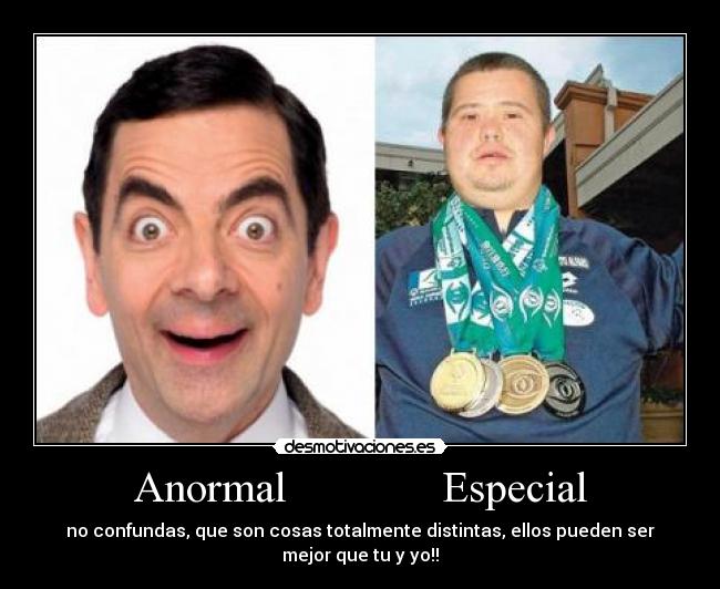 Anormal Especial -