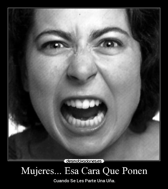 Mujeres... Esa Cara Que Ponen - Cuando Se Les Parte Una Uña.