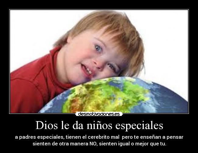 Dios le da niños especiales - 