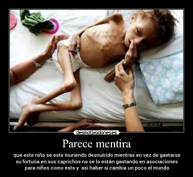 Parece mentira - que este niño se este muriendo desnutrido mientras en vez de gastarse
su fortuna en sus caprichos no se lo están gastando en asociaciones
para niños como esto y asi haber si cambia un poco el mundo