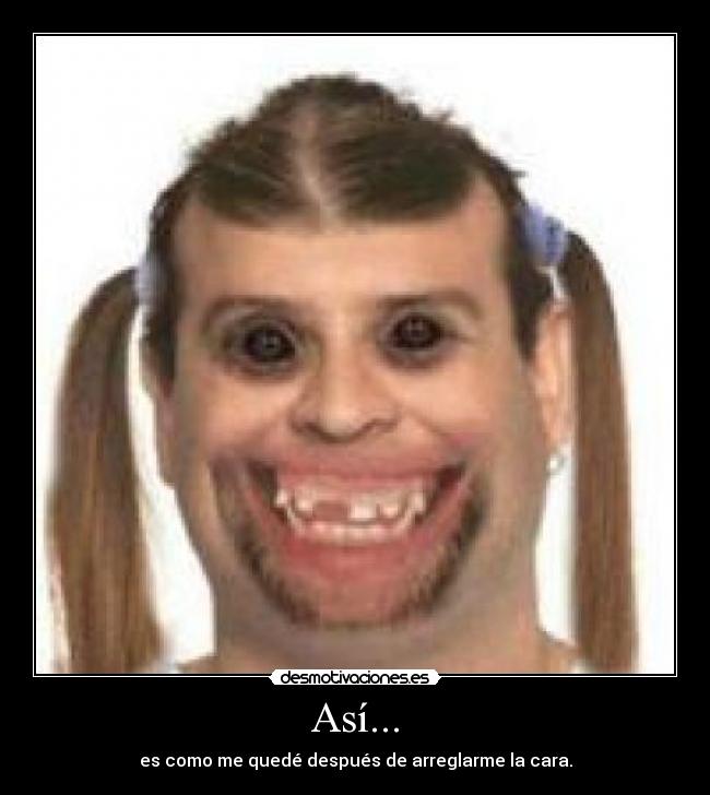 Así... - es como me quedé después de arreglarme la cara.