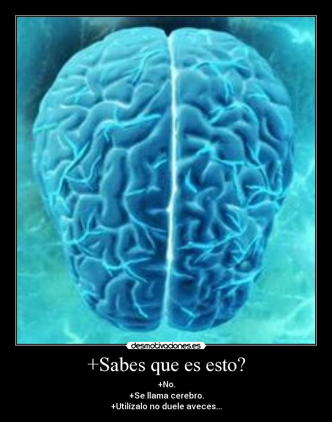 +Sabes que es esto? - 