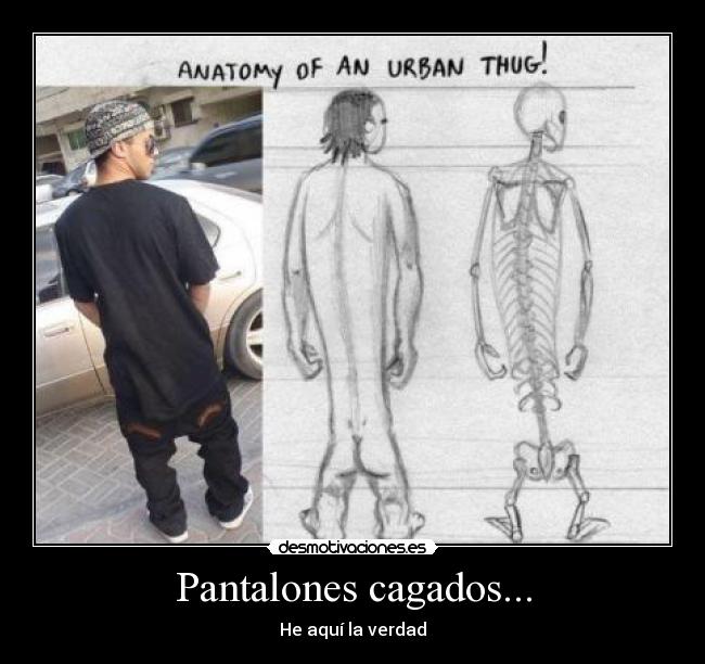 Pantalones cagados... - He aquí la verdad