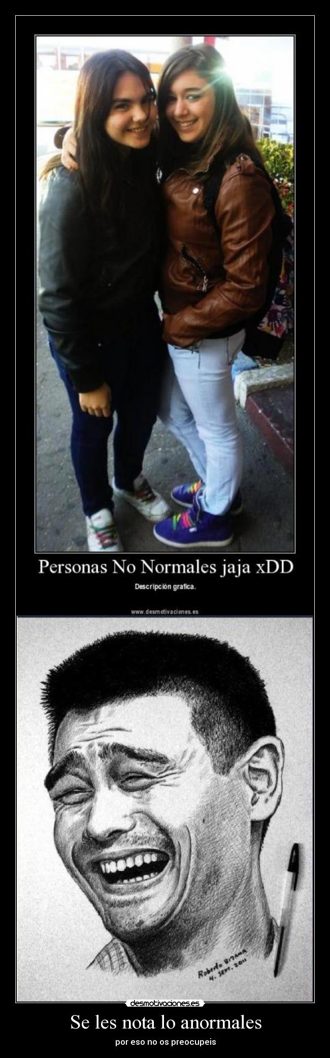 Se les nota lo anormales - 