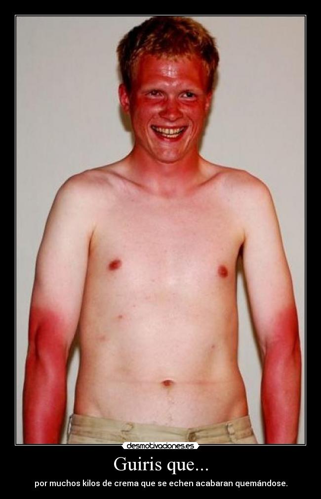 Guiris que... - por muchos kilos de crema que se echen acabaran quemándose.