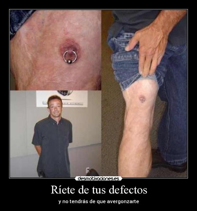 Ríete de tus defectos - 