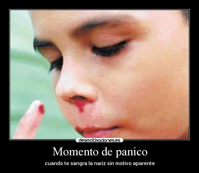 Momento de panico - cuando te sangra la nariz sin motivo aparente
