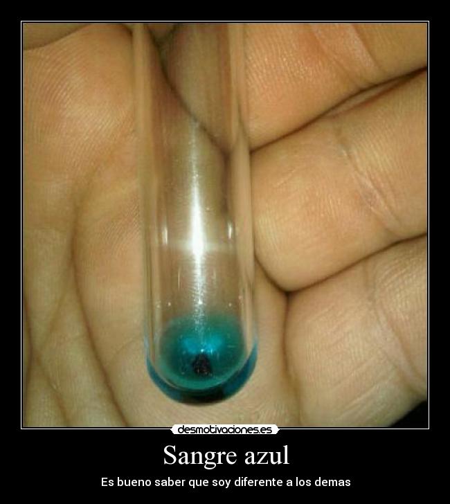 Sangre azul -