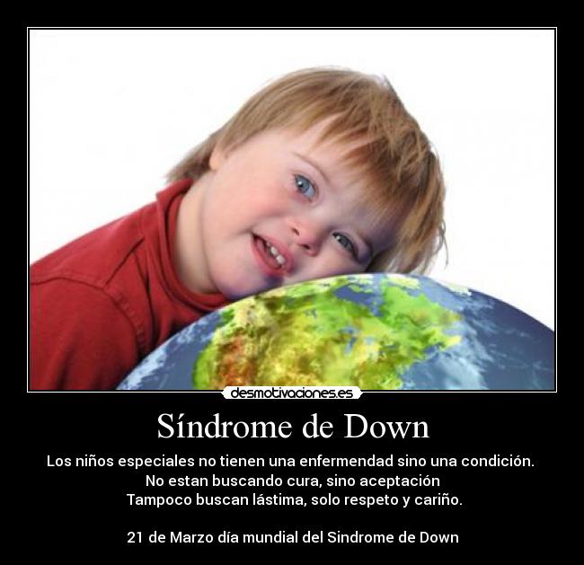 Síndrome de Down - Los niños especiales no tienen una enfermendad sino una condición. 
No estan buscando cura, sino aceptación
 Tampoco buscan lástima, solo respeto y cariño.

21 de Marzo día mundial del Sindrome de Down