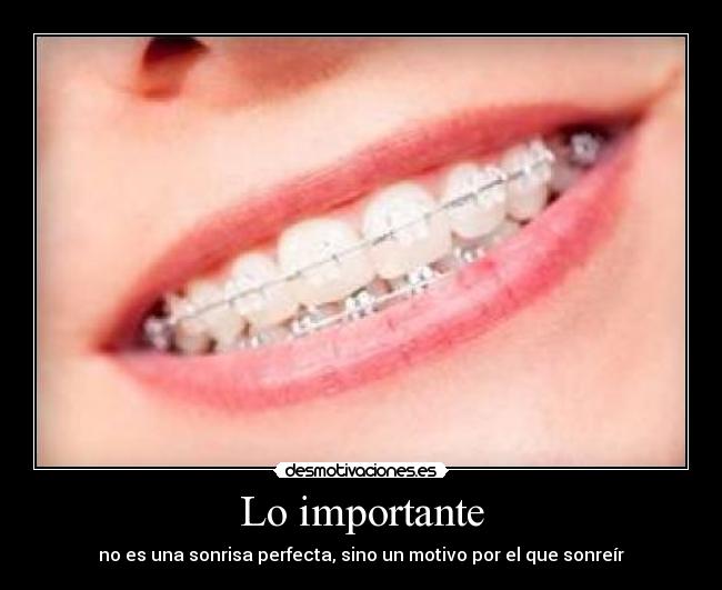 Lo importante - no es una sonrisa perfecta, sino un motivo por el que sonreír