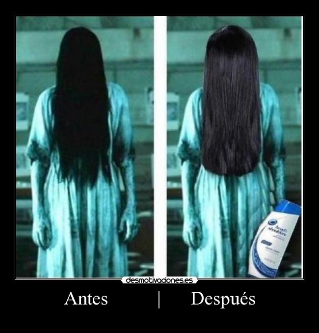 Antes          |      Después - 