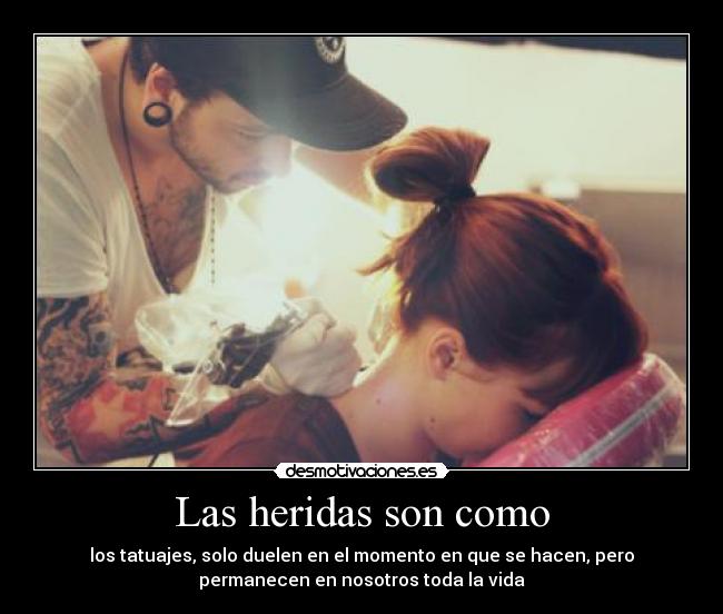 Las heridas son como -