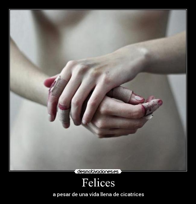 Felices - a pesar de una vida llena de cicatrices