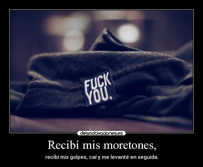Recibí mis moretones, -
