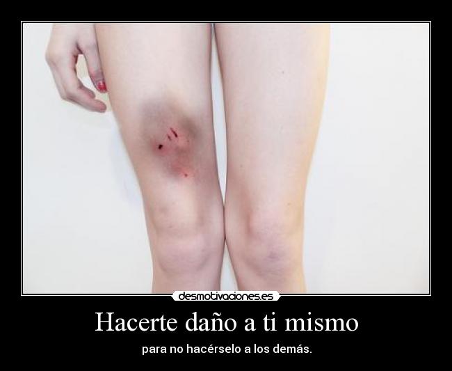 Hacerte daño a ti mismo -
