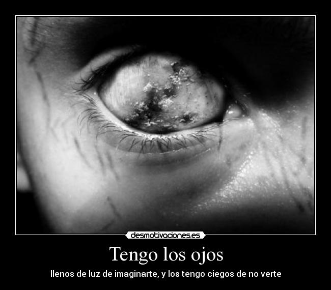 Tengo los ojos - 