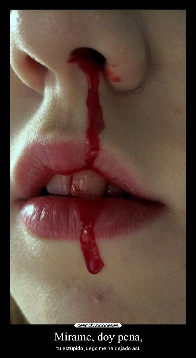 Mírame, doy pena, -