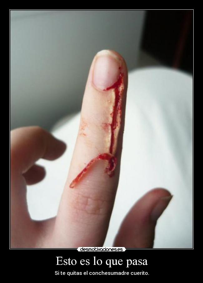 Esto es lo que pasa -