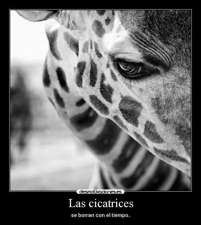 carteles cicatrices desmotivaciones