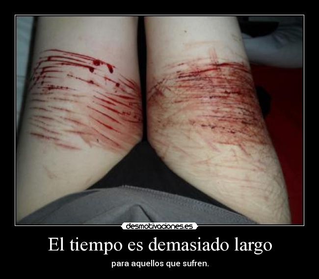 El tiempo es demasiado largo - 
