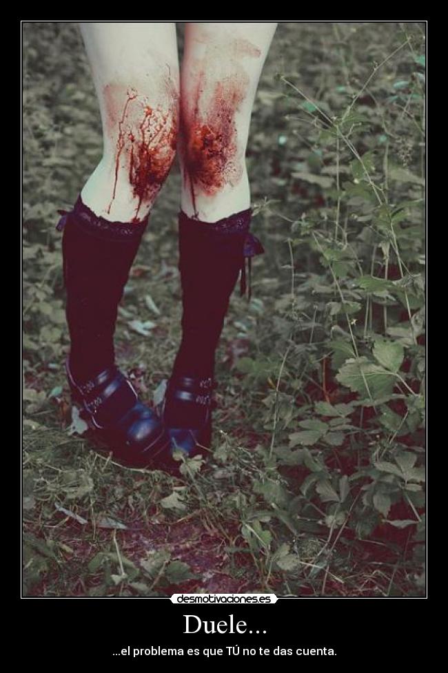 Duele... - ...el problema es que TÚ no te das cuenta.
