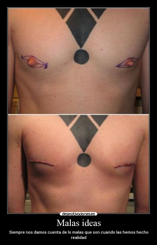 Malas ideas - Siempre nos damos cuenta de lo malas que son cuando las hemos hecho realidad