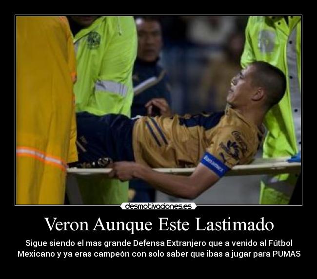 Veron Aunque Este Lastimado - Sigue siendo el mas grande Defensa Extranjero que a venido al Fútbol
Mexicano y ya eras campeón con solo saber que ibas a jugar para PUMAS