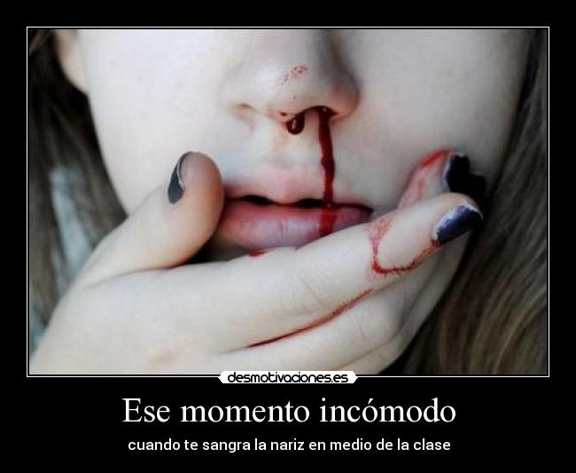 Ese momento incómodo -