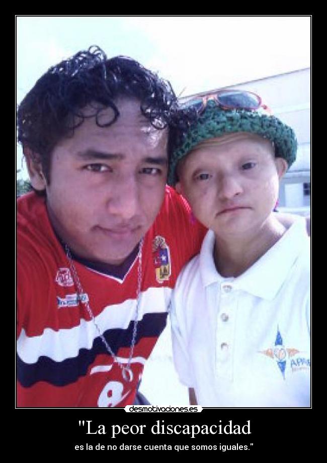 La peor discapacidad - 