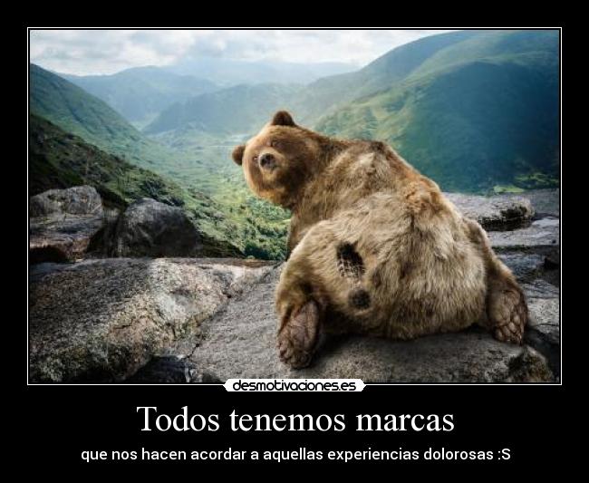 Todos tenemos marcas - que nos hacen acordar a aquellas experiencias dolorosas :S