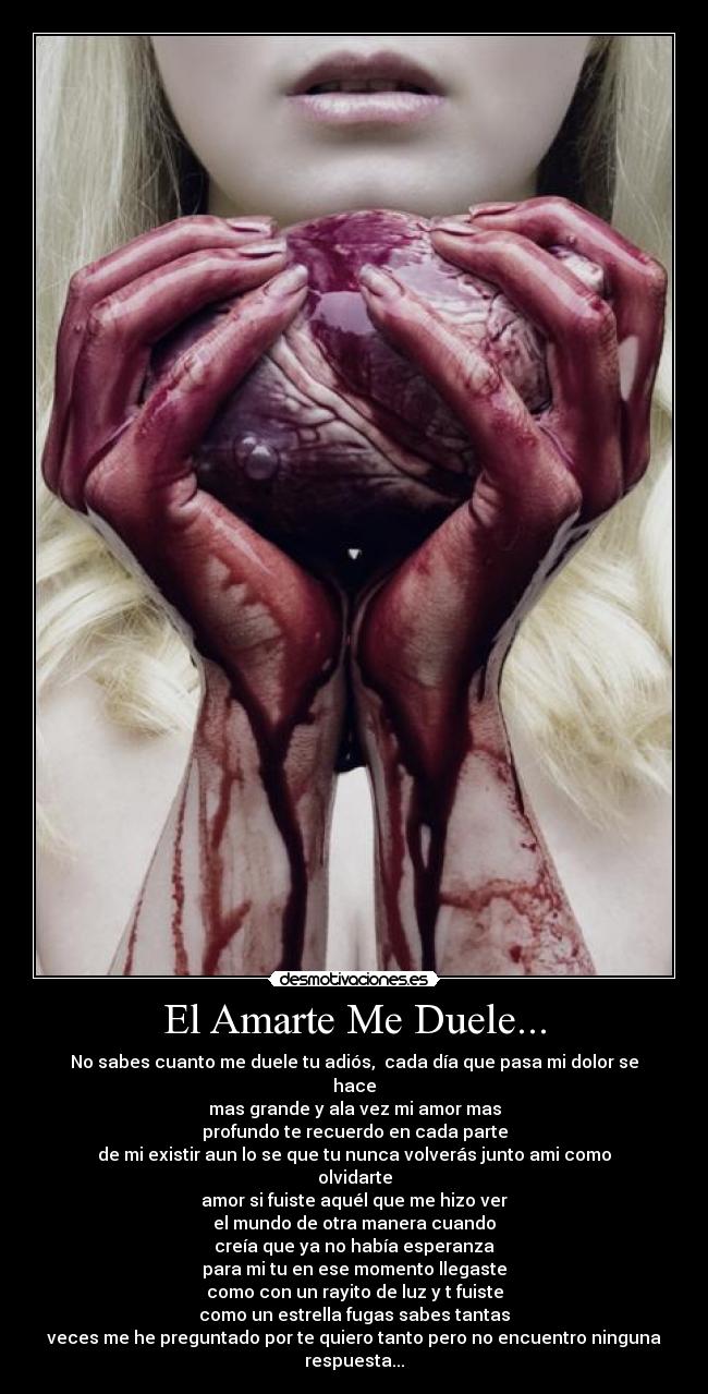El Amarte Me Duele... - 