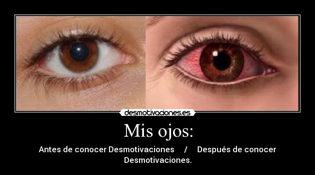 Mis ojos: - 