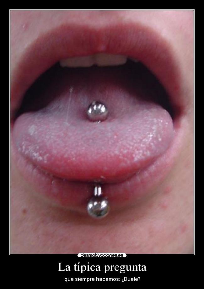 La típica pregunta - que siempre hacemos: ¿Duele?