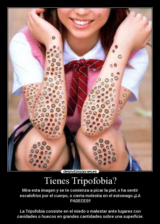 Tienes Tripofobia? - 