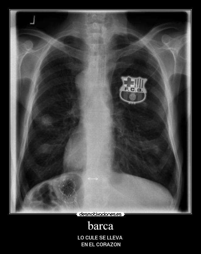 barca - LO CULE SE LLEVA
EN EL CORAZON