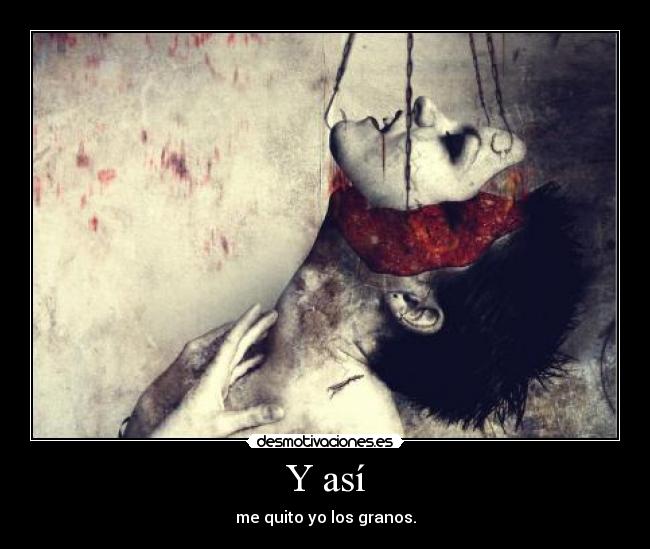 Y así - me quito yo los granos.