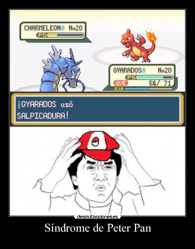 Síndrome de Peter Pan -