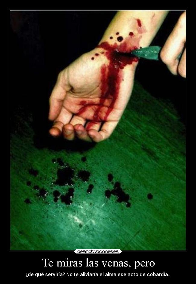Te miras las venas, pero -