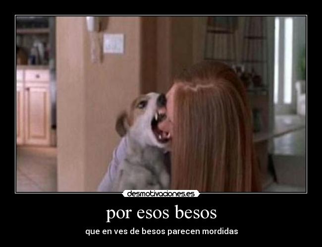 por esos besos - que en ves de besos parecen mordidas