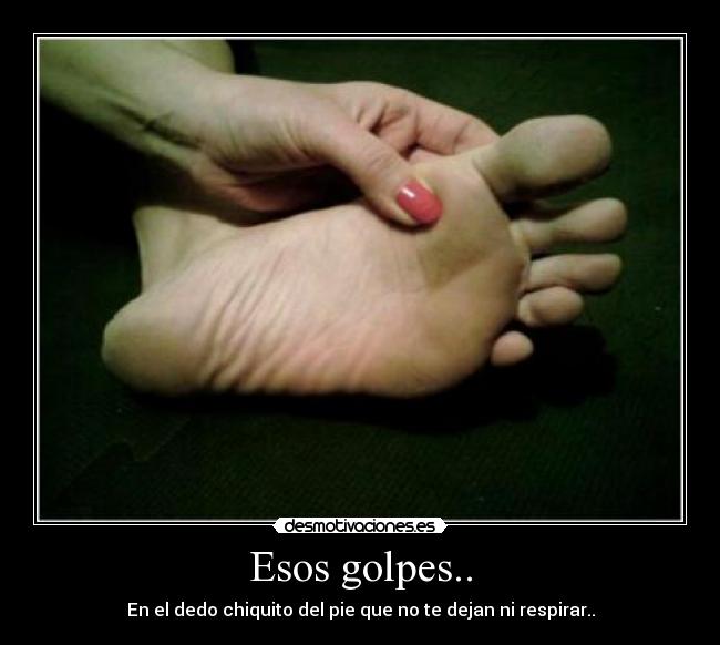 Esos golpes.. - 