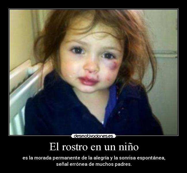 El rostro en un niño - es la morada permanente de la alegría y la sonrisa espontánea,
señal errónea de muchos padres.