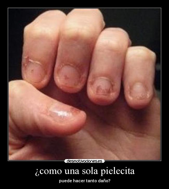 ¿como una sola pielecita - puede hacer tanto daño?